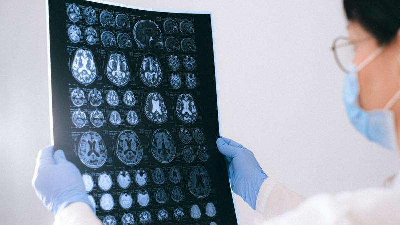 Ez a különleges élelmiszer hozzájárulhat a Parkinson-kór megelőzéséhez.